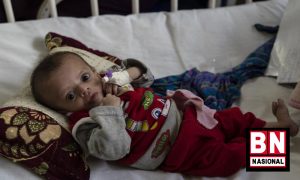 Gizi Buruk Anak Afganistan 300x180