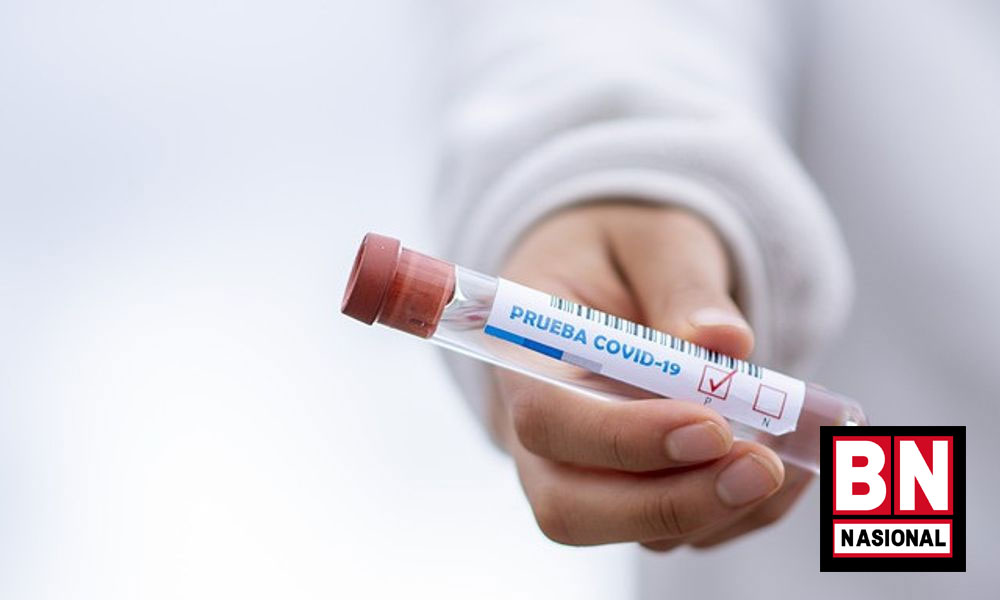 Virus Covid19
