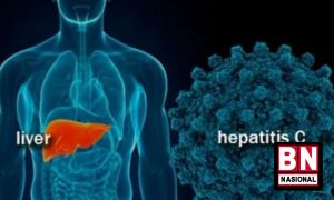 Ini Fase Penyakit Hepatitis Akut Berat Menurut Dokter Spesialis - BN Nasional Ini Fase Penyakit Hepatitis Akut Berat Menurut Dokter Spesialis - BN Nasional