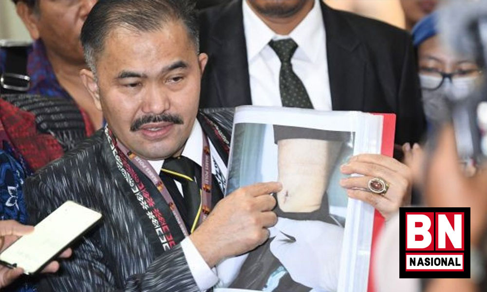 Selidiki Dugaan Penyiksaan Penyebab Kematian, Sebagian Organ Tubuh Brigadir J akan Dibawa ke Jakarta