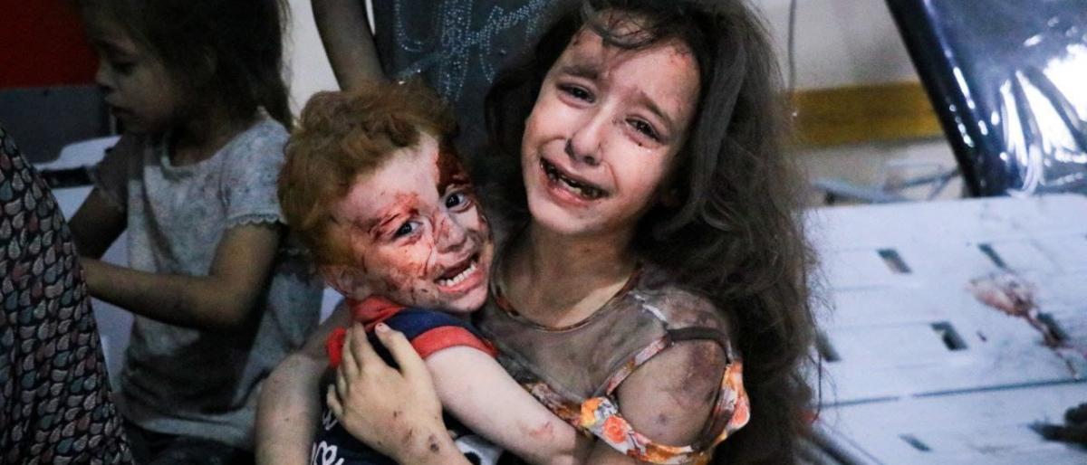 Anak-anak Gaza menjadi korban perang Israel