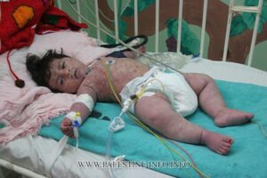 Kementerian Kesehatan: Polio terdeteksi di Gaza
