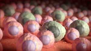 Klinik Mayo Sel Zombie