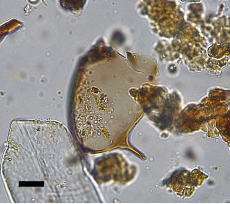 Telur Schistosoma mansoni