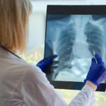 Dokter Memeriksa Paru-Paru Pasien X Ray