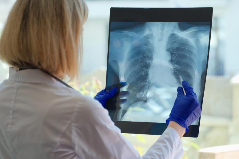 Dokter Memeriksa Paru-Paru Pasien X Ray