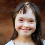 Sindrom Girl Downs Smiling Girl