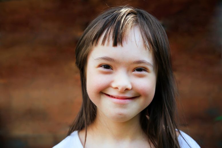 Sindrom Girl Downs Smiling Girl