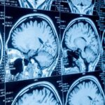 Layar Pemindaian Otak MRI