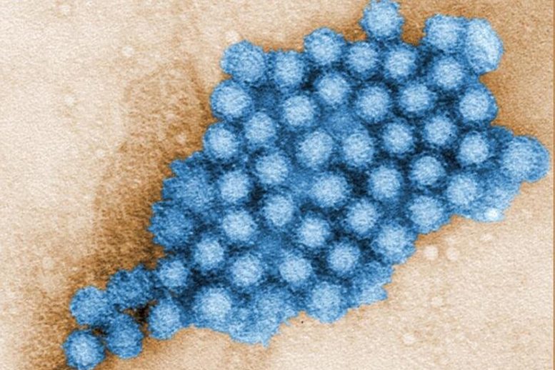 Tampilan mikroskopis partikel norovirus