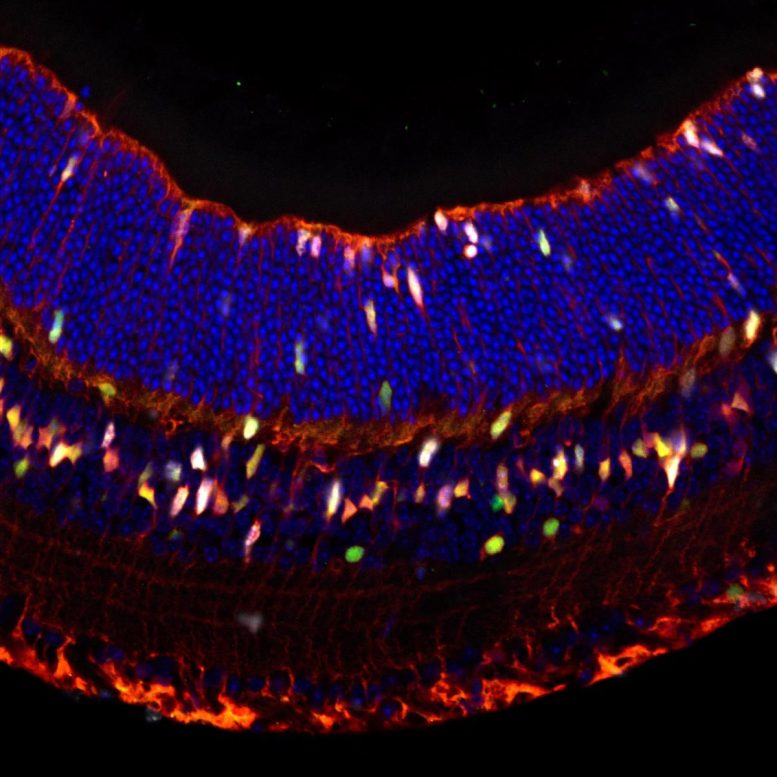 Tikus Retina Müller Glia