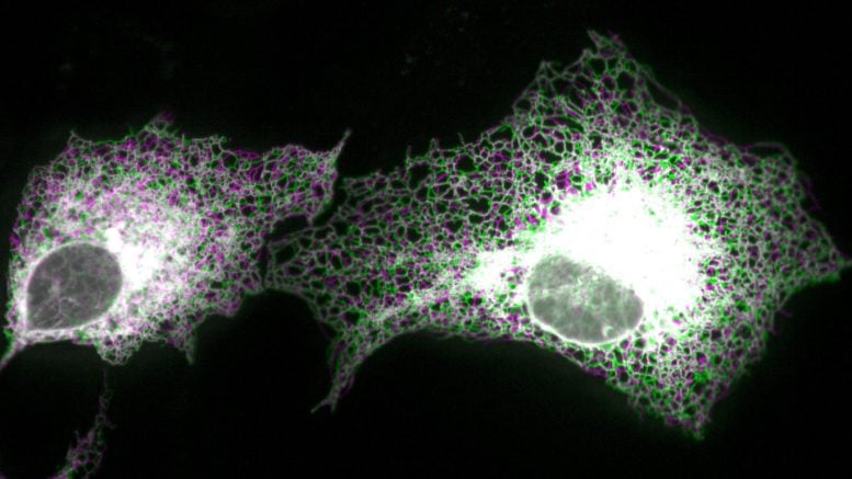Retikulum endoplasma