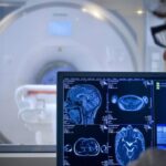 Korteks serebral menua kurang dari yang dipikirkan