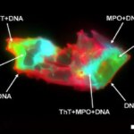 Mikrokot COVID panjang