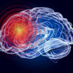 Penggambaran Anatomi Kerusakan Otak