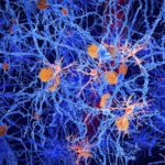 Sel Mikroglia Otak Neuroscience Penyakit Alzheimer