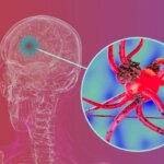 Bahan Kimia Pertanian yang Banyak Digunakan Mungkin Lebih dari Dua Kali Lipat Risiko Penyakit Parkinson