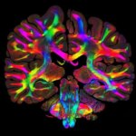 Microfiber Jaringan Otak